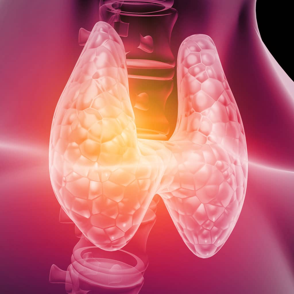 hyperparathyroidism illustration